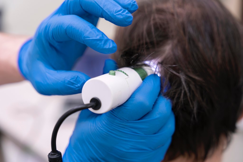 man-getting-hair-loss-treatment