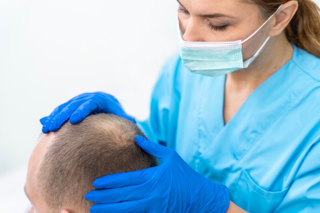 mature-man-having-balding-problems